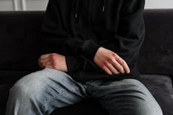 A close-up of a teenager with bruised hands, wearing a hoodie and jeans, sitting on a couch.