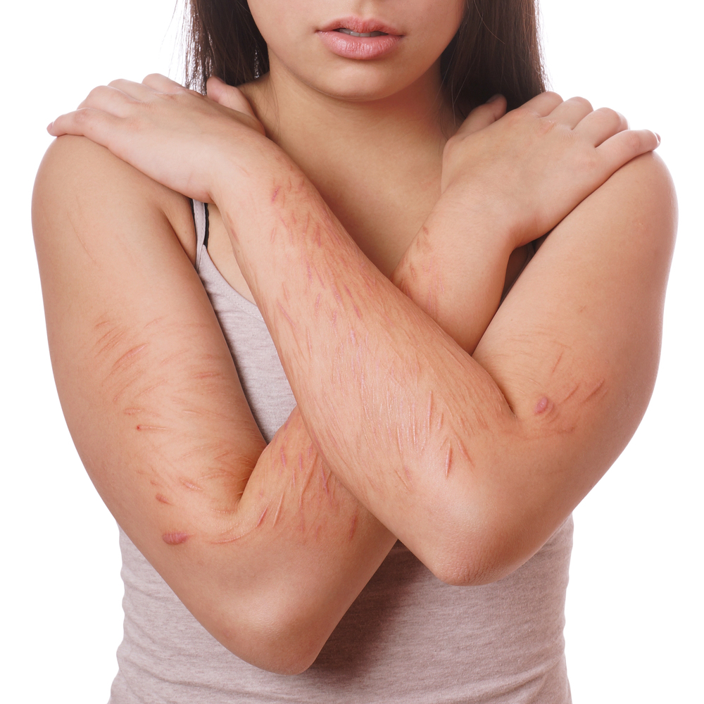 Webinaire - Scarifications à l'adolescence