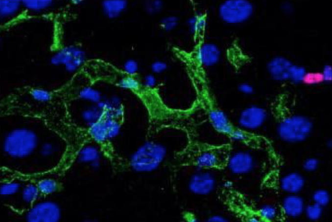 Cibler les cellules sénescentes sans les éliminer pour vivre plus longtemps en bonne santé Cibler les cellules sénescentes sans les éliminer pour vivre plus longtemps en bonne santé
