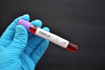 Aspects immunologiques et virologiques de la Covid-19 : état des connaissance Aspects immunologiques et virologiques de la Covid-19 : état des connaissance