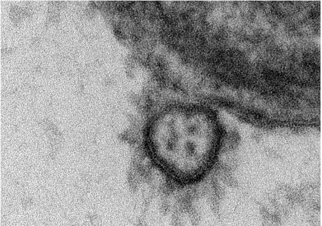 Covid-19 : dans les formes graves, les lymphocytes T non conventionnels sont prédictifs de l’évolution de la maladie Covid-19 : dans les formes graves, les lymphocytes T non conventionnels sont prédictifs de l’évolution de la maladie