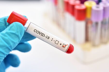 Recommandations aux établissements psy sur la dégradation de l'épidémie de Covid-19 Recommandations aux établissements psy sur la dégradation de l'épidémie de Covid-19