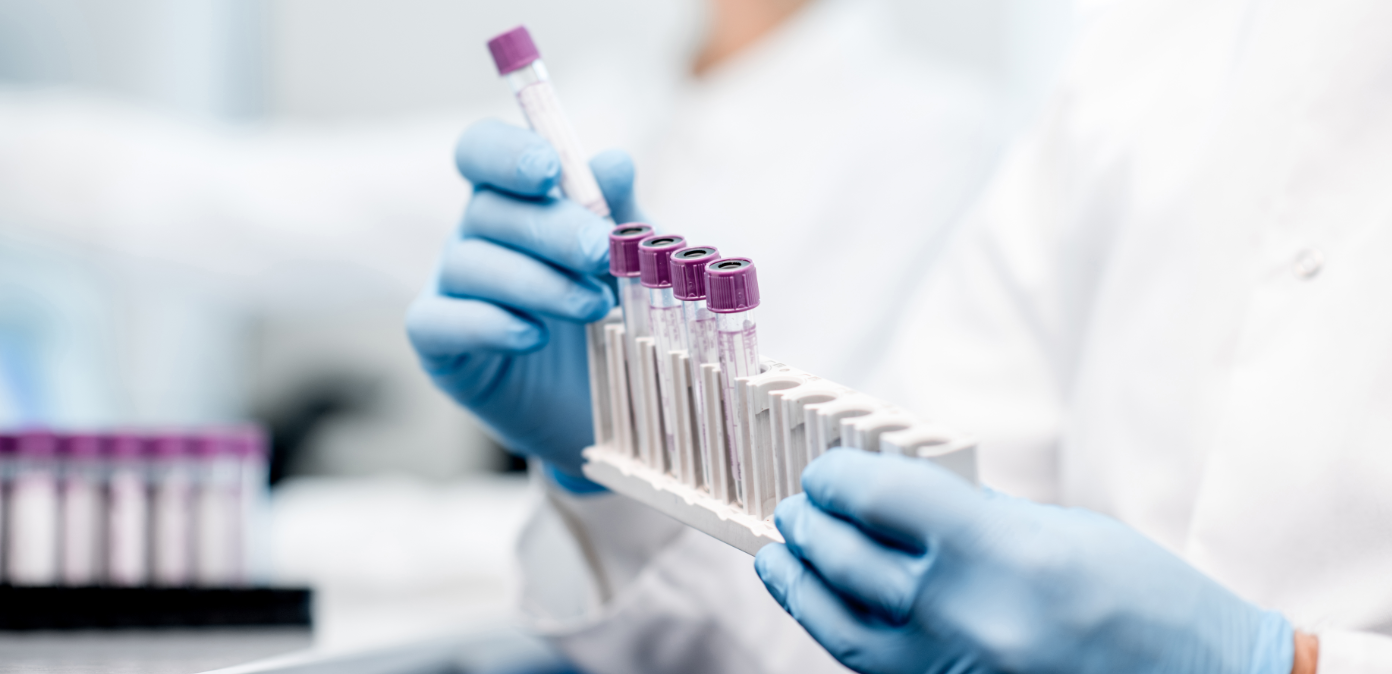Dépression, vers une nouvelle piste biologique ? Dépression, vers une nouvelle piste biologique ?